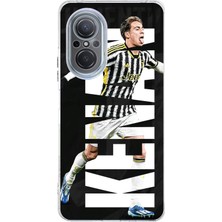 TechTree Huawei Nova 9 Se Uyumlu Kenan Yıldız Sevinç Baskılı Silikon Kılıf