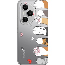TechTree Honor 400 Pro Uyumlu Sevimli Kedi Patiler Tasarımlı Baskılı Silikon Kılıf