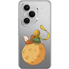 TechTree Honor 400 Pro Uyumlu Küçük Prens Gezegen Boa Tasarımlı Baskılı Silikon Kılıf