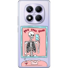 TechTree Redmi Note 14 Pro Plus 5g Uyumlu You Look Good Iskelet Tasarımlı Baskılı Silikon Kılıf