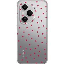 TechTree Honor 400 Pro Uyumlu Kırmızı Kalpler Tasarımlı Baskılı Silikon Kılıf