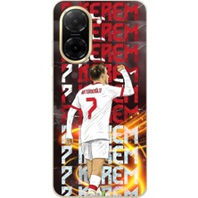 TechTree Redmi A5 Uyumlu Kerem Aktürkoğlu Sevinç Baskılı Silikon Kılıf