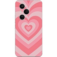 TechTree Honor 400 Pro Uyumlu Pembe Kalpler Baskılı Silikon Kılıf