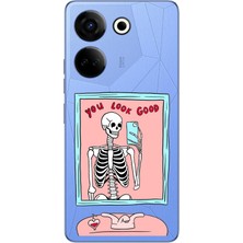 TechTree Tecno Camon 20 - 20 Pro 4g Uyumlu You Look Good Iskelet Tasarımlı Baskılı Silikon Kılıf