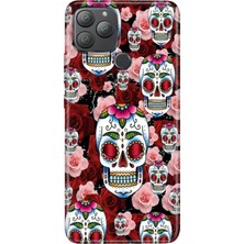 Egstech General Mobile Gm 22 Plus Kılıf Desenli Esnek Silikon Uv Kabile