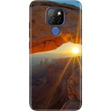 Egstech General Mobile Gm 20 Kılıf Desenli Silikon Case Uv Sun