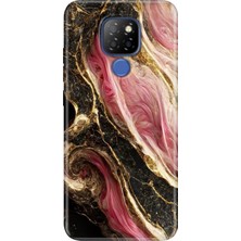 Egstech General Mobile Gm 20 Kılıf Desenli Silikon Case Uv Seattle Mermer