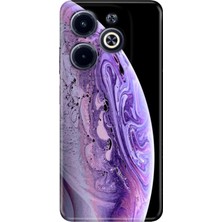 Egstech Infinix Hot 40I Kılıf Temalı Baskılı Kapak World