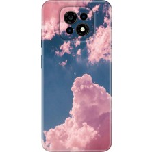 Egstech Casper Via M30 Kılıf Outlet Desenli Ermer Kapak Silikon Pembe Bulut