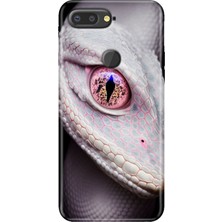 Egstech General Mobile Gm 9 Pro Kılıf Desenli Esnek Silikon Kapak Uv Dişicobra