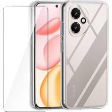 Teleplus Honor 400 Kılıf Kamera Korumalı Tpu Kılıf ve Ekran Koruyucu
