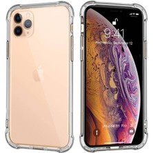 Ennar Apple iPhone 11 Pro Uyumlu Darbeye Dayanıklı Köşe Korumalı Kılıf Anti Şok Şeffaf Kapak