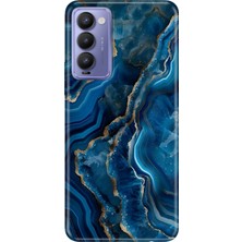 Senada Tecno Camon 18 Kılıf Desenli Baskılı Tpu Rubber Kapak Dark Ametist
