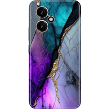 Senada Honor 400 Kılıf Desenli Baskılı Tpu Rubber Kapak Altın Tozu