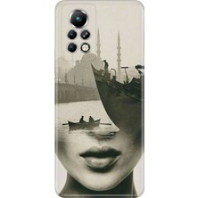 Senada Infinix Note 11 Pro Kılıf Desenli Baskılı Tpu Rubber Kapak Istanbul