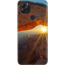 Adasena General Mobile Gm 22 -22S Kılıf Desenli Baskılı Tpu Rubber Kapak Sun