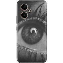 Senada Honor 400 Kılıf Desenli Baskılı Tpu Rubber Kapak Hologram Göz