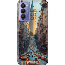 Senada Tecno Camon 18 Kılıf Desenli Baskılı Tpu Rubber Kapak Galata Francisco