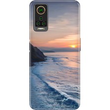 Senada General Mobile Gm 22 Pro Kılıf Desenli Baskılı Tpu Rubber Kapak Huzur