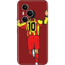 Senada Honor 400 Pro Kılıf Desenli Baskılı Tpu Rubber Kapak Hagi