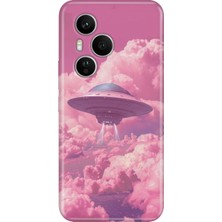 Honor 400 Pro Kılıf Desenli Baskılı Tpu Rubber Kapak Pembe Ufo