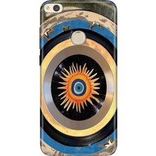 Huawei P9 Lite 2017 Kılıf Desenli Baskılı Tpu Rubber Kapak Nazar