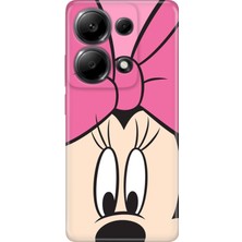 Xiaomi Redmi Note 13 Pro 4g Kılıf Desenli Baskılı Tpu Rubber Kapak Minnie Love