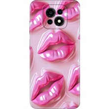 Casper Via M30 Kılıf Desenli Baskılı Tpu Rubber Kapak Mucuk