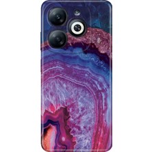 Adasena Infinix Smart 8 - 8 Pro Kılıf Desenli Baskılı Tpu Rubber Kapak Morametist
