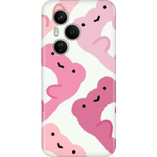 Adasena Honor 400 Pro Kılıf Desenli Baskılı Tpu Rubber Kapak Pink Frogs