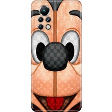 Adasena Infinix Note 11 Pro Kılıf Desenli Baskılı Tpu Rubber Kapak Lv-Mickey