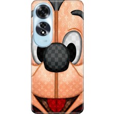 Adasena Oppo A60 Kılıf Desenli Baskılı Tpu Rubber Kapak Lv-Mickey