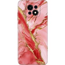 Casper Via M30 Kılıf Desenli Baskılı Tpu Rubber Kapak Pembe MERMER32