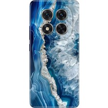 Adasena Xiaomi Redmi Note 14 Pro 5g Kılıf Desenli Baskılı Tpu Rubber Kapak Otto Marble