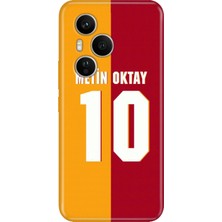Honor 400 Pro Kılıf Desenli Baskılı Tpu Rubber Kapak Metin Oktay