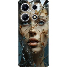 Senada Infinix Note 30 Vip Kılıf Desenli Baskılı Tpu Rubber Kapak Cam Kırığı