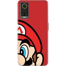 Adasena General Mobile Gm 22 Pro Kılıf Desenli Baskılı Tpu Rubber Kapak Mario
