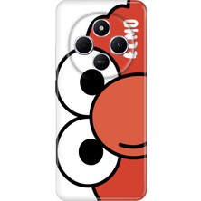 Senada Xiaomi Redmi A4 5g Kılıf Desenli Baskılı Tpu Rubber Kapak Elmo