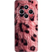 Adasena Xiaomi Redmi A4 5g Kılıf Desenli Baskılı Tpu Rubber Kapak Pembe Çitah
