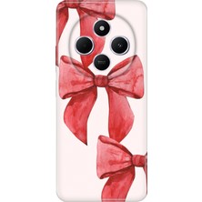 Adasena Xiaomi Redmi A4 5g Kılıf Desenli Baskılı Tpu Rubber Kapak Kurdele Sanat