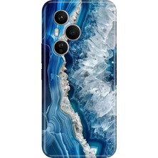Adasena Honor 400 Pro Kılıf Desenli Baskılı Tpu Rubber Kapak Otto Marble