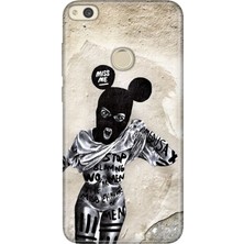 Senada Huawei P9 Lite 2017 Kılıf Desenli Baskılı Tpu Rubber Kapak Artful Minnie