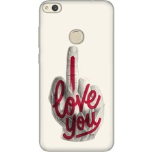 Senada Huawei P9 Lite 2017 Kılıf Desenli Baskılı Tpu Rubber Kapak I Love You