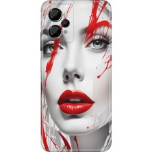 Casper Via X30 Kılıf Desenli Baskılı Tpu Rubber Kapak Lady