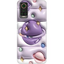 Senada General Mobile Gm 22 Pro Kılıf Desenli Baskılı Tpu Rubber Kapak 3D Space