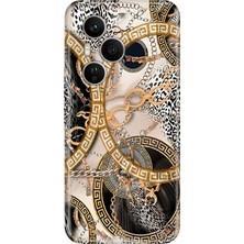 Adasena Honor 400 Pro Kılıf Desenli Baskılı Tpu Rubber Kapak Vrsc