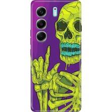 Senada Tecno Camon 40 Pro 5g Kılıf Desenli Baskılı Tpu Rubber Kapak Iskelet 111