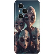 Adasena Honor 400 Pro Kılıf Desenli Baskılı Tpu Rubber Kapak Ufo