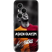 Senada Honor 400 Pro Kılıf Desenli Baskılı Tpu Rubber Kapak Aşkınolayım