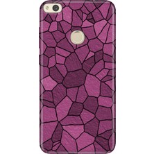 Adasena Huawei P9 Lite 2017 Kılıf Desenli Baskılı Tpu Rubber Kapak Pinkwall